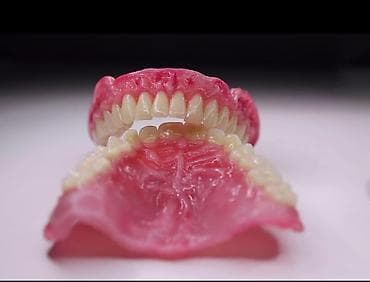 2020 dirnaq bezekleri: Her növ total protezlərin hazırlanması bir başa paciente — 6