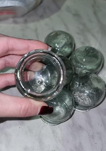 tipsi ile dirnaq qaynagi nedir: Şüşə bankalar – vakuum fincanları (cupping) dəsti - Material: qalın — 2