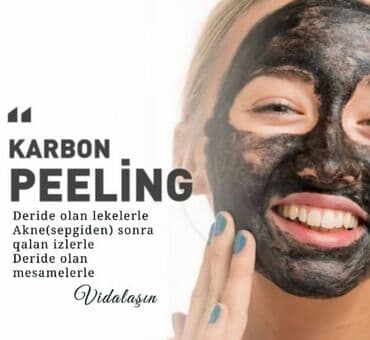 столовая в аренду: Tecili!!! SATILIR VE YA ARENDAYA VERİLİR (AYLIQI 350 AZN)endirim — 3