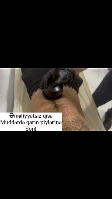 masaj: Skolioz masajı, Böyüklər üçün, Klinikada — 1