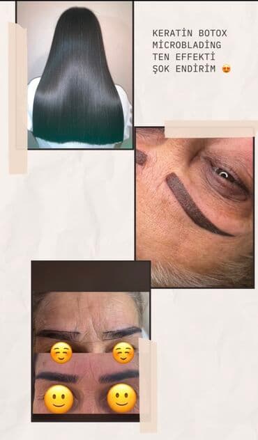 Şok şok şok endirim ay sonunacan Unvan Bakixanov Qarantiya 100