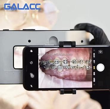 konsul: 📸 Stomatoloji fotoqrafiya üçün LED işıqlandırma sistemi – smartfon — 1