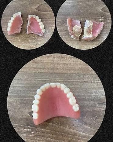 ustalar qrupu whatsapp: Qırılmiş cat, dişi duşmuş cixan protezlerin Hemin gun erzinde tez — 2