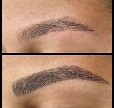 qısa saç modelləri: Seyrek formasiz qaslarin mikrobledinqle berpasi — 9