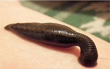 Məhsul: Tibbi zəlili 1 ədədi 2 azn