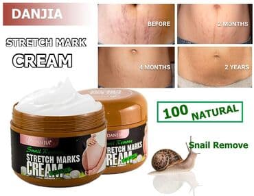 крем барои нараки руй: Çat kremi orginal Krem hamiləlik arıqlama və ya artım nəticəsində — 1