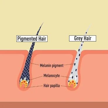 sari tukler ucun lazer: Ağ tüklərin epilyasiyası. Adi lazerin götürmədiyi tükləri bizim xüsusi — 1