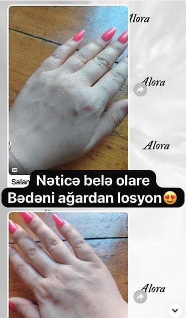 ucuz etir: ✨ QOLTUQALTI • BİKİNİ • DİZ • DİRSƏK ÜÇÜN AĞARDICI LOSYON ✨ — 2