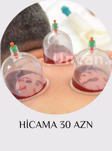 sari tukler ucun lazer: Bəylər üçün = Hicama Və Zəli ✅Zəlinin Faydaları(Hirudoterapiya) — 4