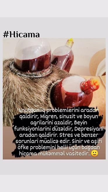 uz masaji: Bəylər üçün = Lazer Epilasiyasi✅Hicama və Zəli✅Masaj✅Çistka✅Ayaq — 7