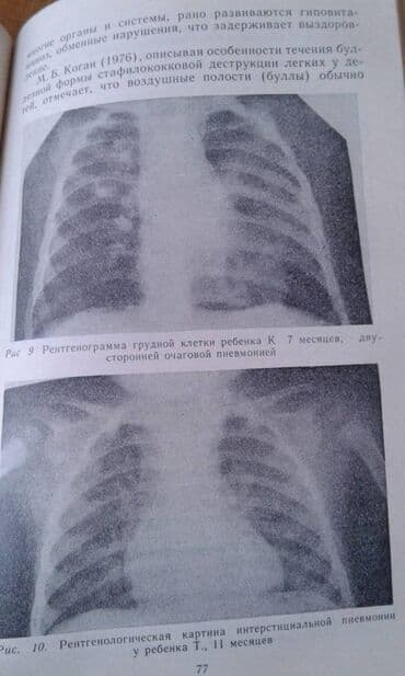 объявления няня на дому: Продаются разные книги: "Как вырастить здорового ребенка". 40 манат — 29