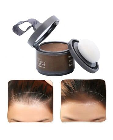 saç botoksu qiymeti: ❇️❇️Saç teni Keçəl yerləri doldurmaq üçen saç teni ❇️❇️❤️ 2 rəng — 2