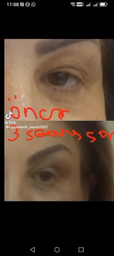 hekim sekli: Estetik xidmətlər: üz və bədən üçün qeyri‑invaziv kontur formalaşdırma — 1