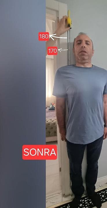 boya isleri: Boy uzatma 45 yaşa kimi Rustam Akhmetov metodu ilə 45 yaşa kimi boya — 4