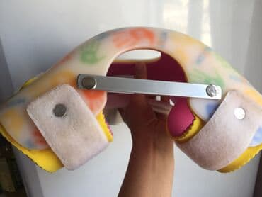 Tibbi avadanlıq: Bud chanaq displaziyasinda shina . Ushaq uchun ortopedik shina 50 man — 2