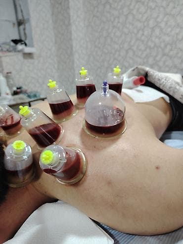 ərəb dili: Xidmətlərimiz: Hicama (steril, 1 dəfəlik ləvazimatlarla) — 4