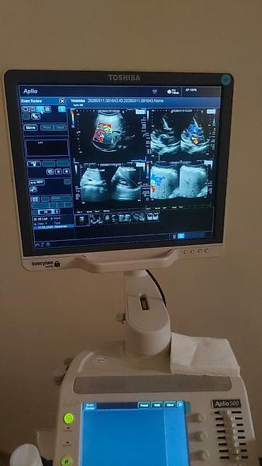 Toshiba Aplio 500 crystal seri ultrasəs aparatı - Yüksək — 4