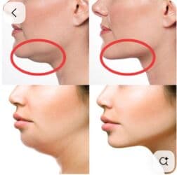 qarin eritmek ucun krem: Estetik–plastik cərrahiyyə və bədən formalaşdırma xidmətləri Təklif — 3