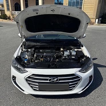 audi 6: Hyundai Avante: 1.6 l | 2015 il Sedan — 4
