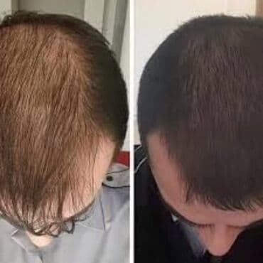 wow sac serumu: Saç düzümü üçün vasitələr, Yeni, Pulsuz çatdırılma — 3