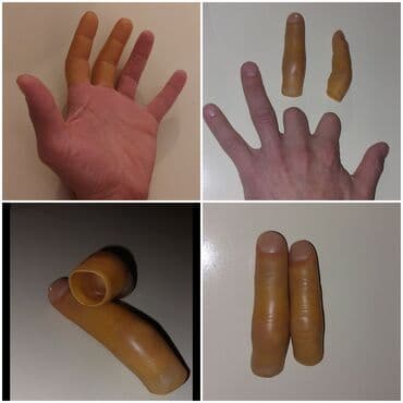 oksigen balonu icin reduktor: Turkiyenin "REHA The Art of Prosthetics" klinikasinda duzeldilib, Sol — 1