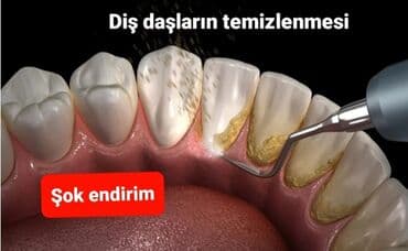 rengsaz elan: Hefte sonu ş ok endirim — 1