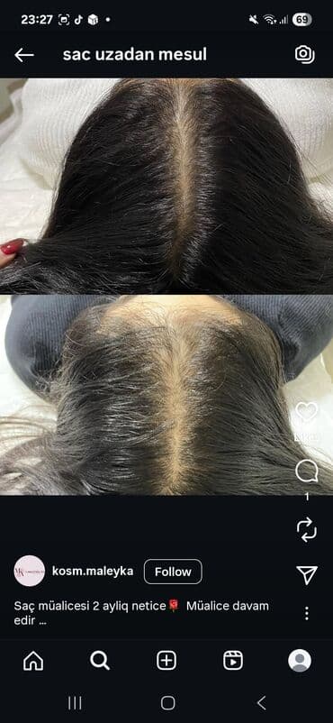 таблетки для похудения в баку: Saç üçün yağ, Saç tökülməsinə qarşı — 27