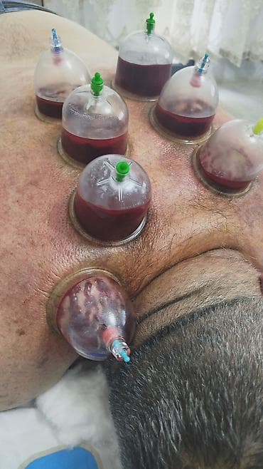 gencede xeste baxicisi: Müalicəvi masaj, Kişilər üçün, Qadınlar üçün, Evə gəlməklə — 3