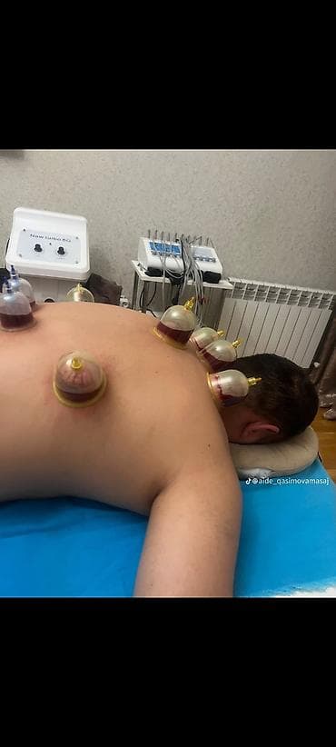 ingilis dili qrammatika: Xidmət: Hicama (qanın vakuumla çıxarılması) və banka terapiyası — 2