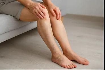 gozelik salonu: Varikoz müalicəsi, Evə gəlməklə, Klinikada — 2