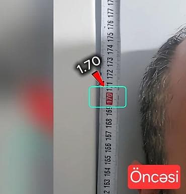 boya isleri: Boy uzatma 45 yaşa kimi Rustam Akhmetov metodu ilə 45 yaşa kimi boya — 3