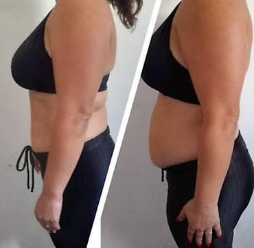 daye xadime: Tibbi və Müalicəvi xidmət olaraq fəaliyyət göstərirəm.Qarın və Yan — 2