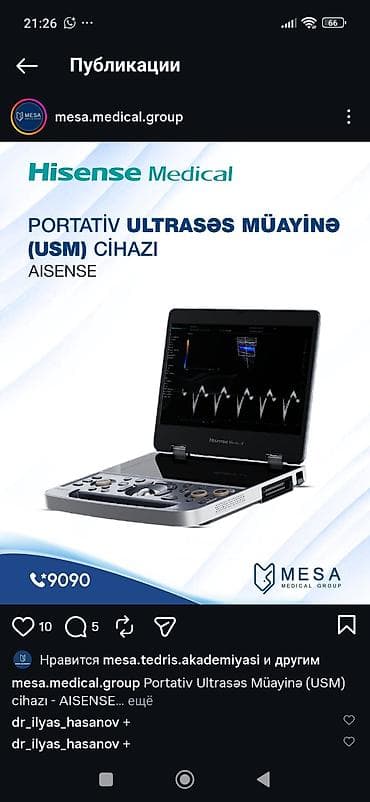 hissense: Hisense Medical AISENSE – Portativ Ultrasəs Müayinə (USM) cihazı - — 1