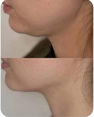 hekim sekli: Estetik xidmətlər: üz və bədən üçün qeyri‑invaziv kontur formalaşdırma — 2