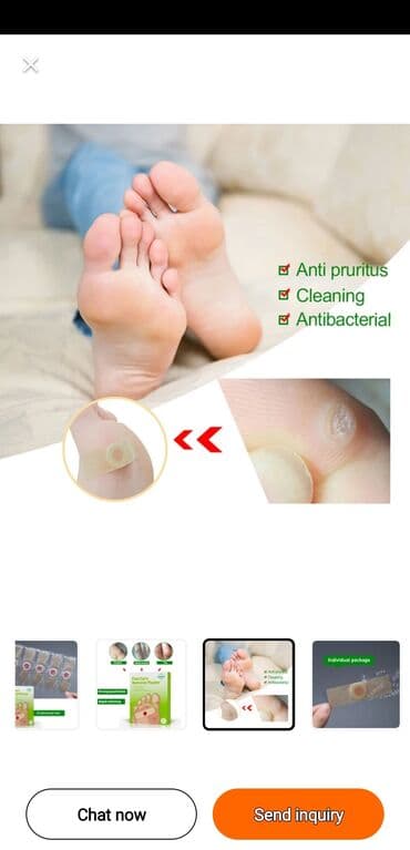 depi maz: Ayaq mazollarını dəf etmək üçün — 4