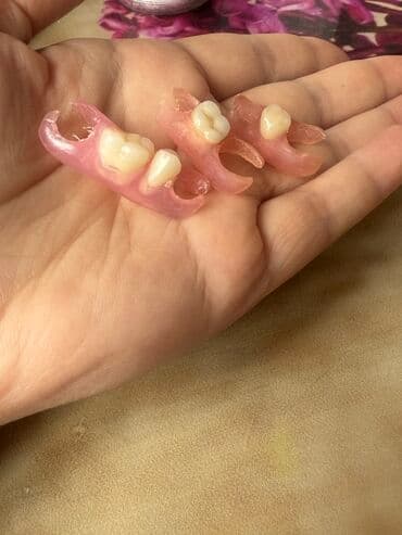 утягивающее белье для полных женщин: Məhsul: Fleks protez tipli hissəvi dişlər (1–2 dişlik sekmentlər).uvuz — 2