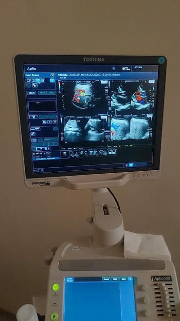 Toshiba Aplio 500 crystal seri ultrasəs aparatı - Yüksək — 2