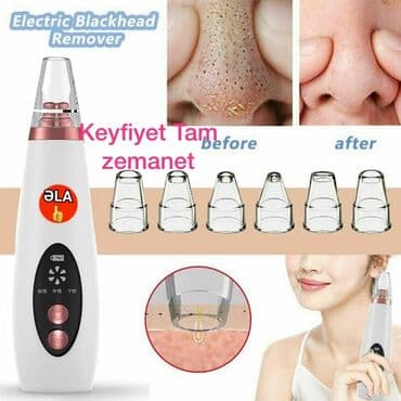 ciska aparatı: ✅Mohera vakum ✅üz temizleyen aparat ✅Zaryatqa ile işleyir — 1