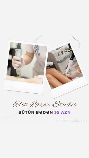 ELIT lazer studio Pesakar lazeroloqlar xidmetinizde.Yeni endirimler