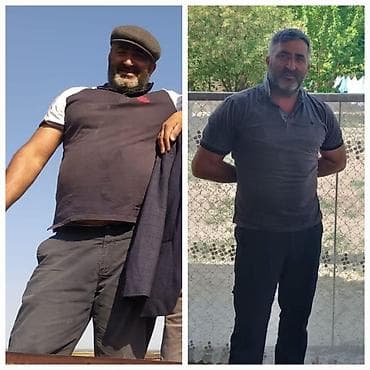 gozelik salon: Xidmət: fərdi arıqlama və bədənformalaşdırma proqramı Təsvir: - Foto — 4