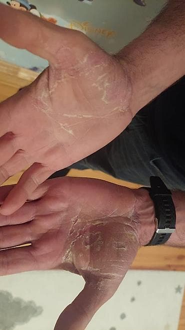 алоэ гулу: Məhsul: Forever Living Aloe Vera Gel içki və Aloe MSM Gel Aloe Vera — 8