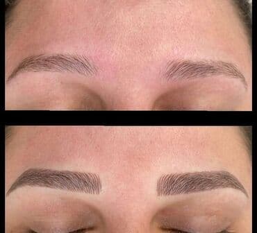 qısa saç modelləri: Seyrek formasiz qaslarin mikrobledinqle berpasi — 10