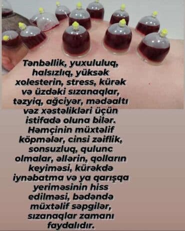 ağ dırnaq modelleri: Hicamanın Faydaları✅ *Qan dövranın pozulması *Qanın təmizlənməsi — 11