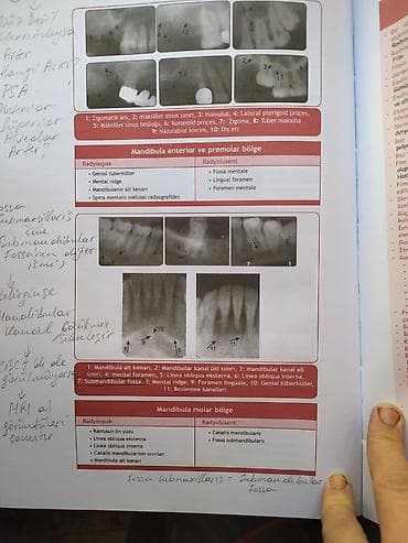 Tibbi avadanlıq: 🦷 DİŞ HƏKİMLƏRİ VƏ DİŞ HƏKİMLİYİ FAKÜLTƏSİ TƏLƏBƏLƏRİ ÜÇÜN! 🦷 📢 DUS-A — 2