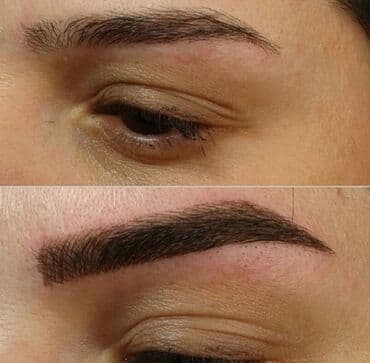 qısa saç modelləri: Seyrek formasiz qaslarin mikrobledinqle berpasi — 3