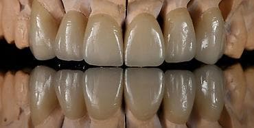 Paltar tikişi: Salam hörmətli və dəyərli Diş Həkimlərimiz.mən diş Texnikiyem.Bakının — 7