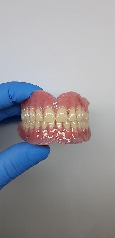 2020 dirnaq bezekleri: Her növ total protezlərin hazırlanması bir başa paciente — 7