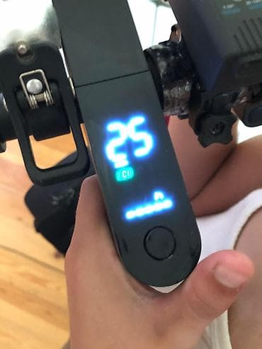 Elektrik nəqliyyatı: Ideal veziyyetdedir hec bir problemi yoxdu real aliciya endirim var su — 5