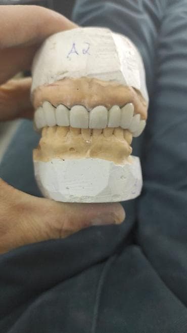 Услуги: Diş texnikliyi kursları(6 ay erzinde tam öyredilir, stomotoloji — 7