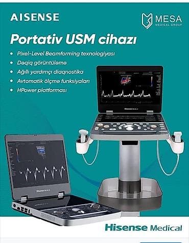 hissense: Hisense Medical USM cihazları – portativ və premium sinif ultrasəs — 1